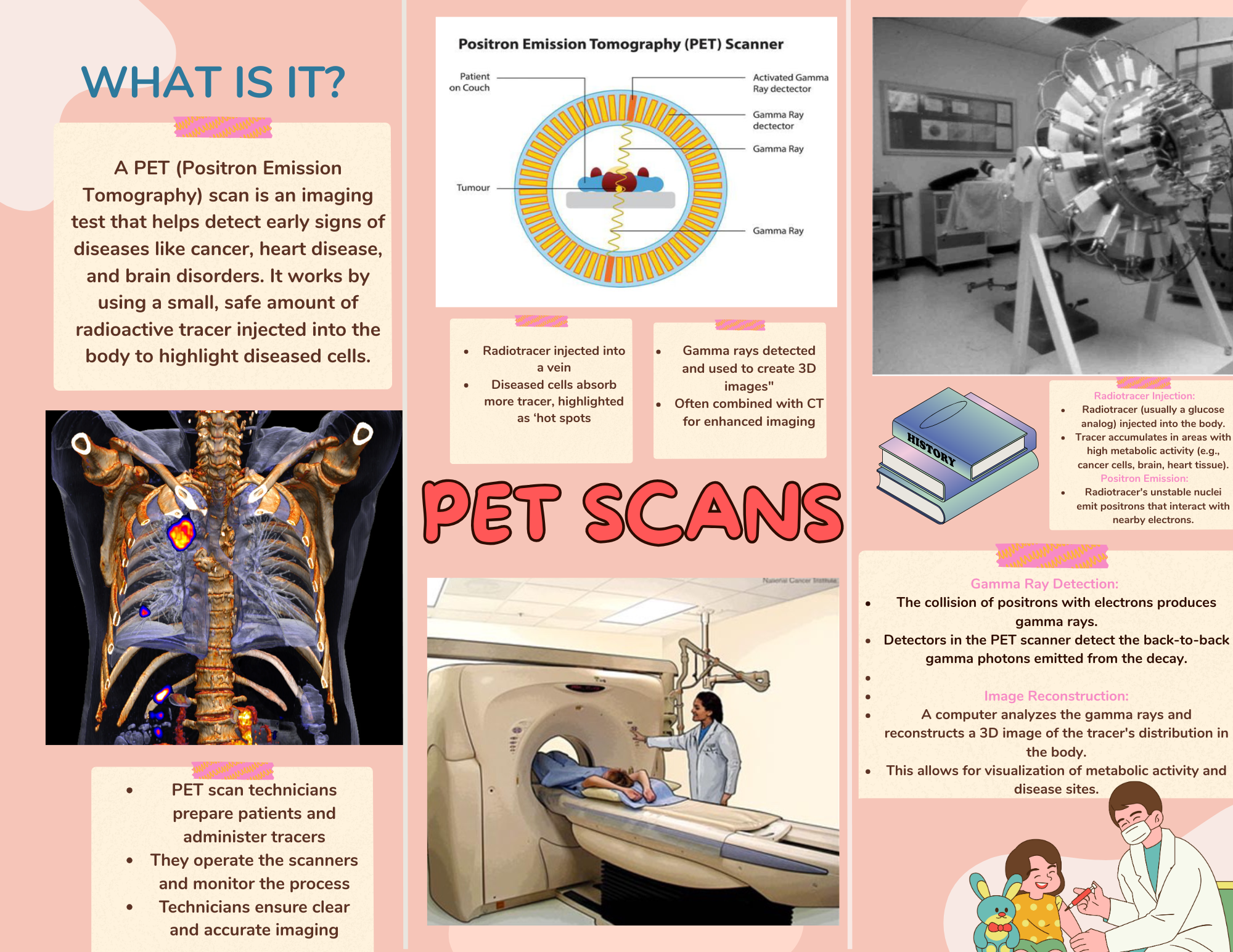 PET Scans (Positron Emission Tomography)